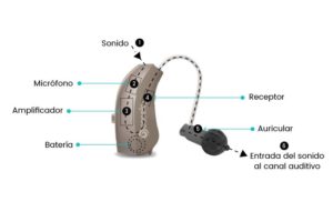 partes de un audífono